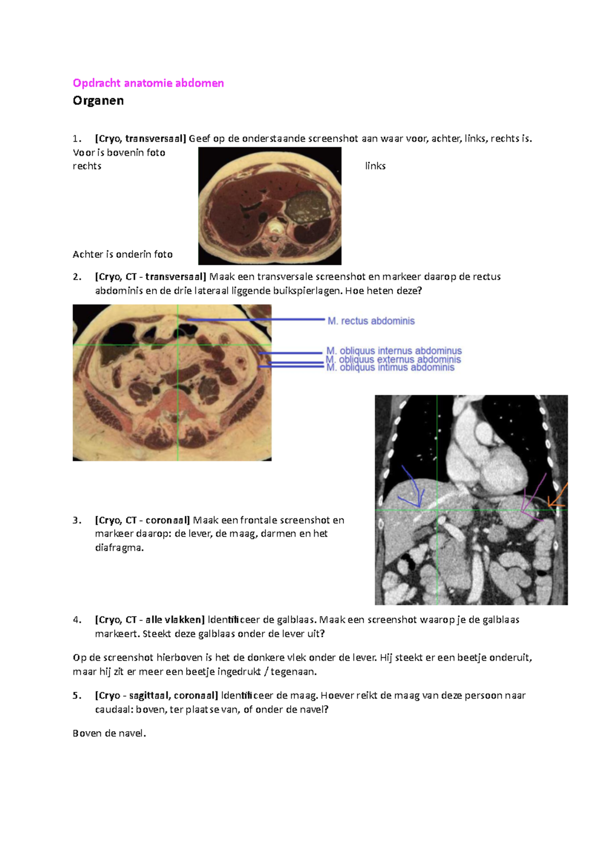 G1SS WC Opdracht anatomie abdomen - Opdracht anatomie abdomen Organen ...