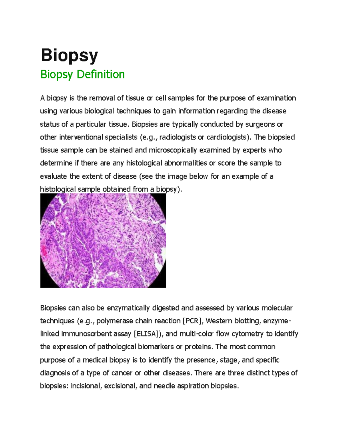 Biopsy Biopsy Biopsy Definition A biopsy is the removal of tissue or