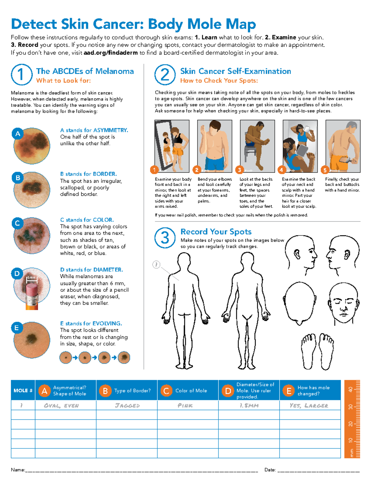 Body-mole-map dermatology - The ABCDEs of Melanoma ####### What to Look ...