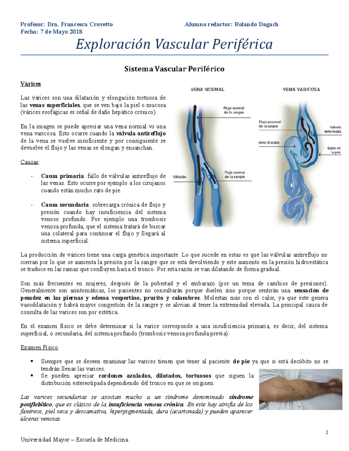 picior medical fizică cultură de la varico conspirații de tratament cu varicoză