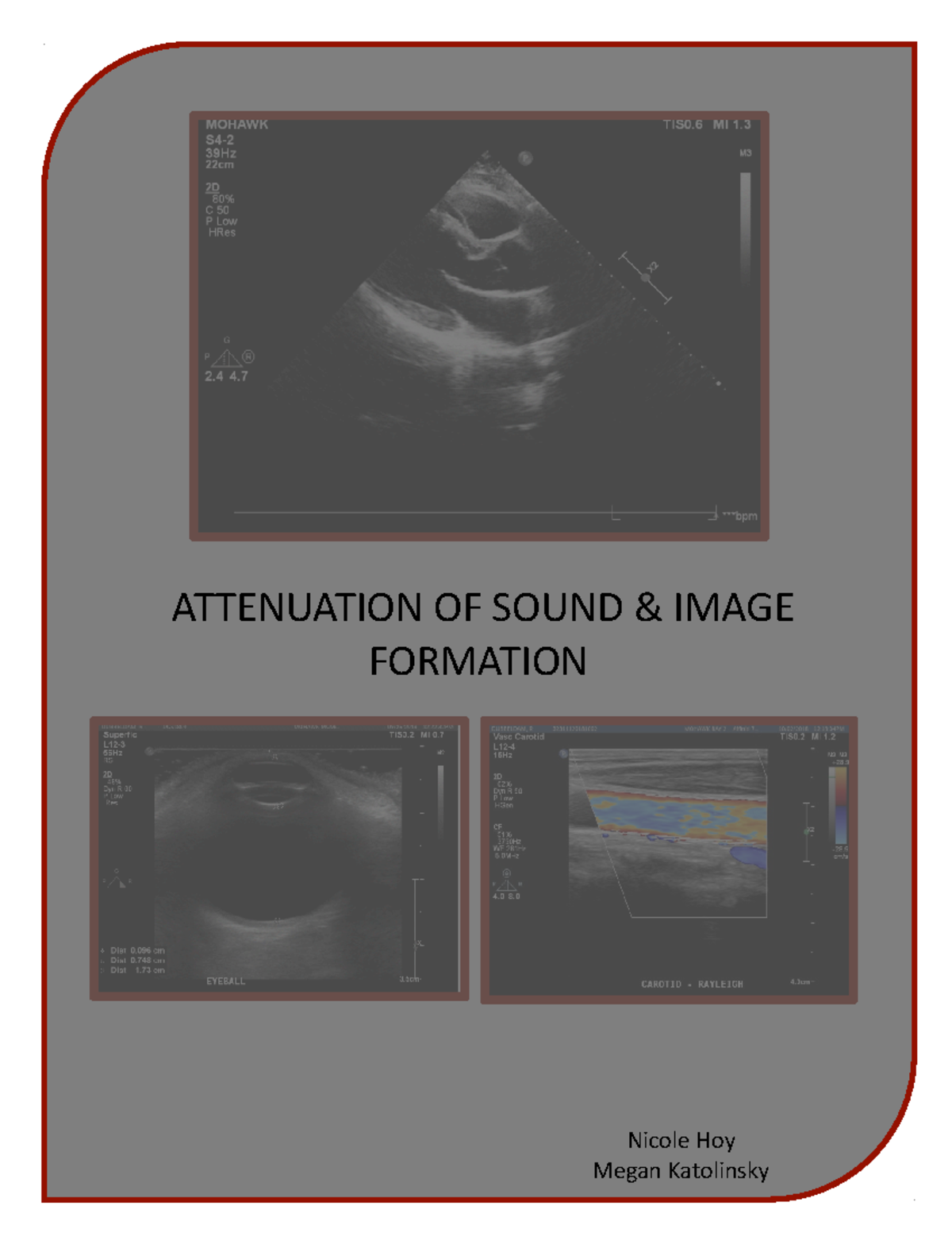 Attenuation of Sound Grade 85 ATTENUATION OF SOUND & IMAGE