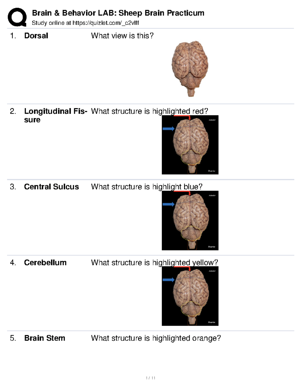 Quizlet Sheep Brain Practicum - Study online at quizlet/_c2vlff Dorsal ...