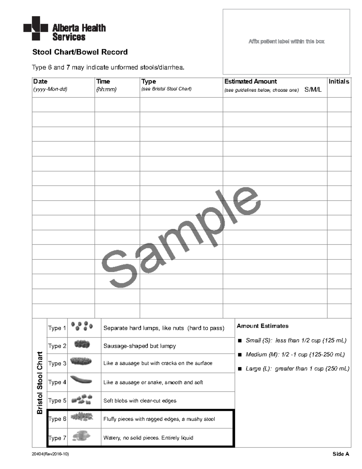 hi-ipc-sz-stool-chart-sample-stool-chart-bowel-record-20404-rev2016