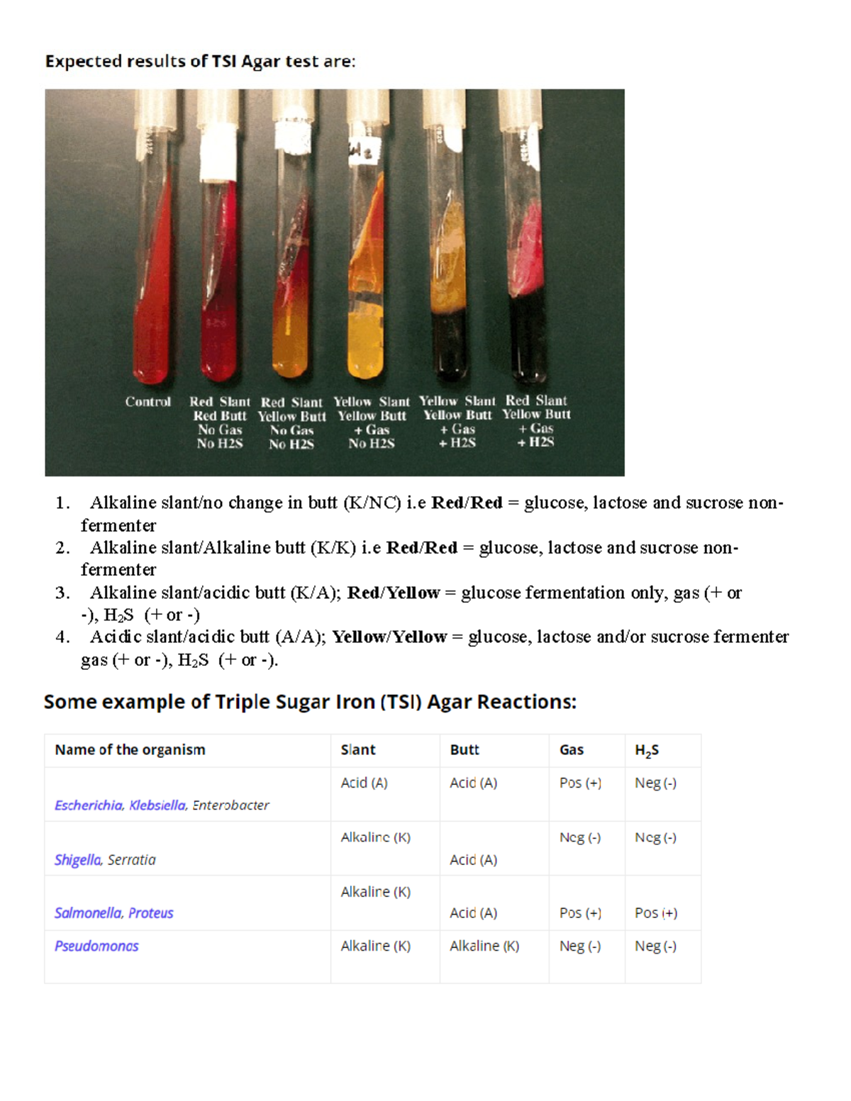 TSI Citrate Durreshehwar Department Of Microbiology Alkaline Slant 