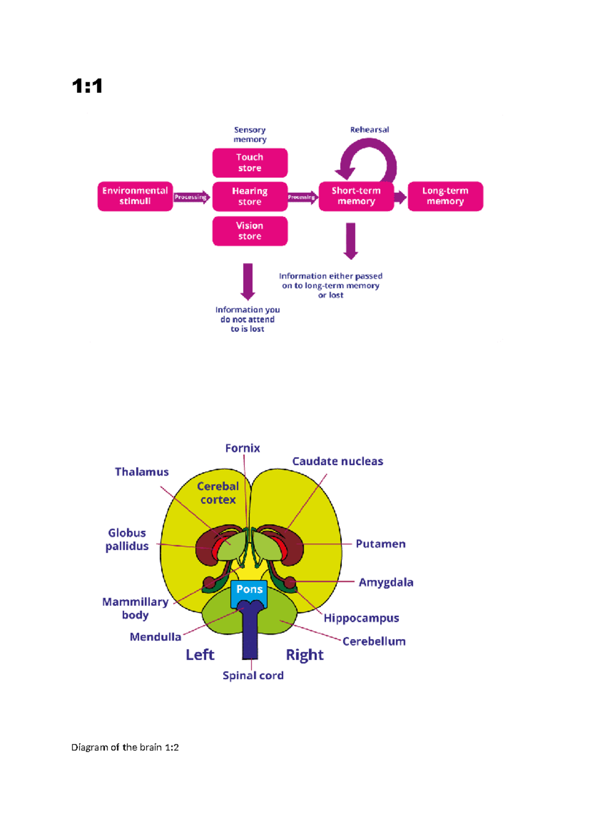 Understanding Dementia - Diagram of the brain 1: The medical model of ...