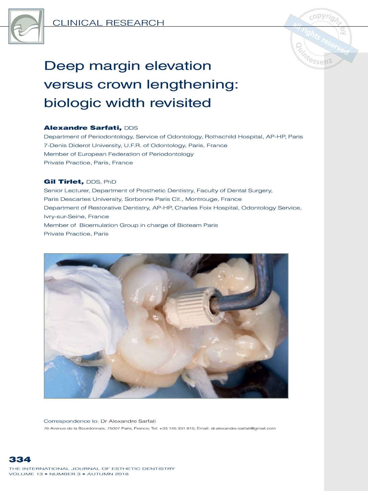 deep-margin-elevation-versus-crown-lengthening-biologic-width