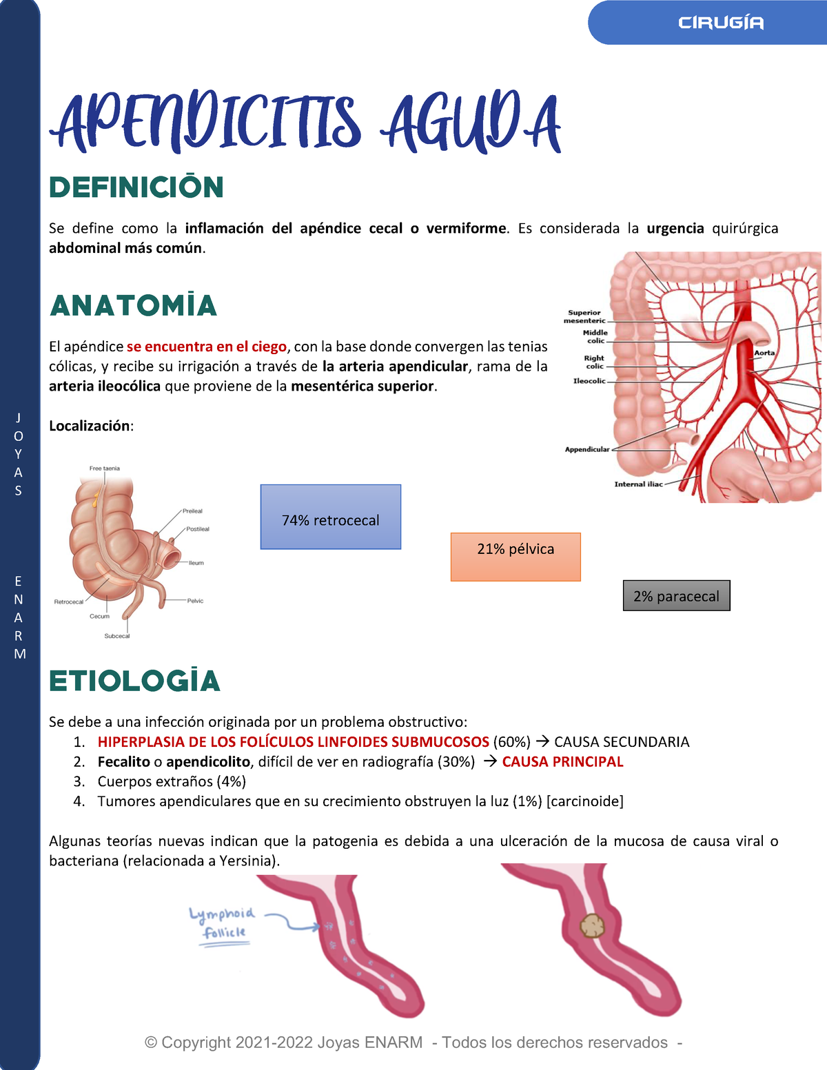 Apendicitis Aguda Resumen J O Y A S E N A R M APENDICITIS AGUDA DEFINICIÓN Se define como