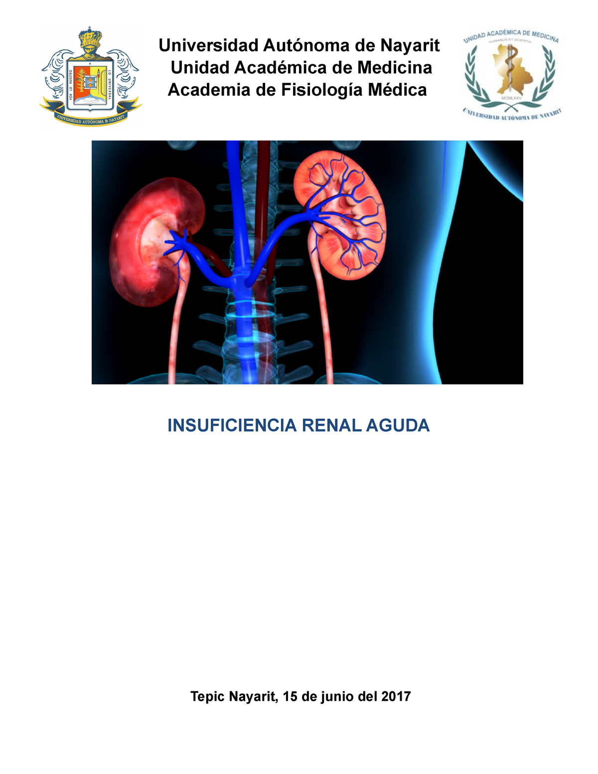 Insuficiencia Renal Aguda Definición Fisiopatología Tratamiento Y Diagnóstico Universidad 6809