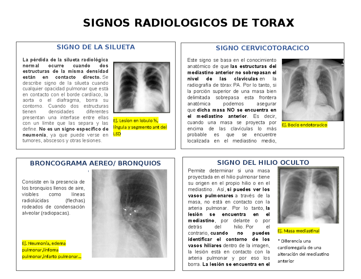 Signos Rx Tx Flash CARD - Proyecciones radiológicas - SIGNOS ...
