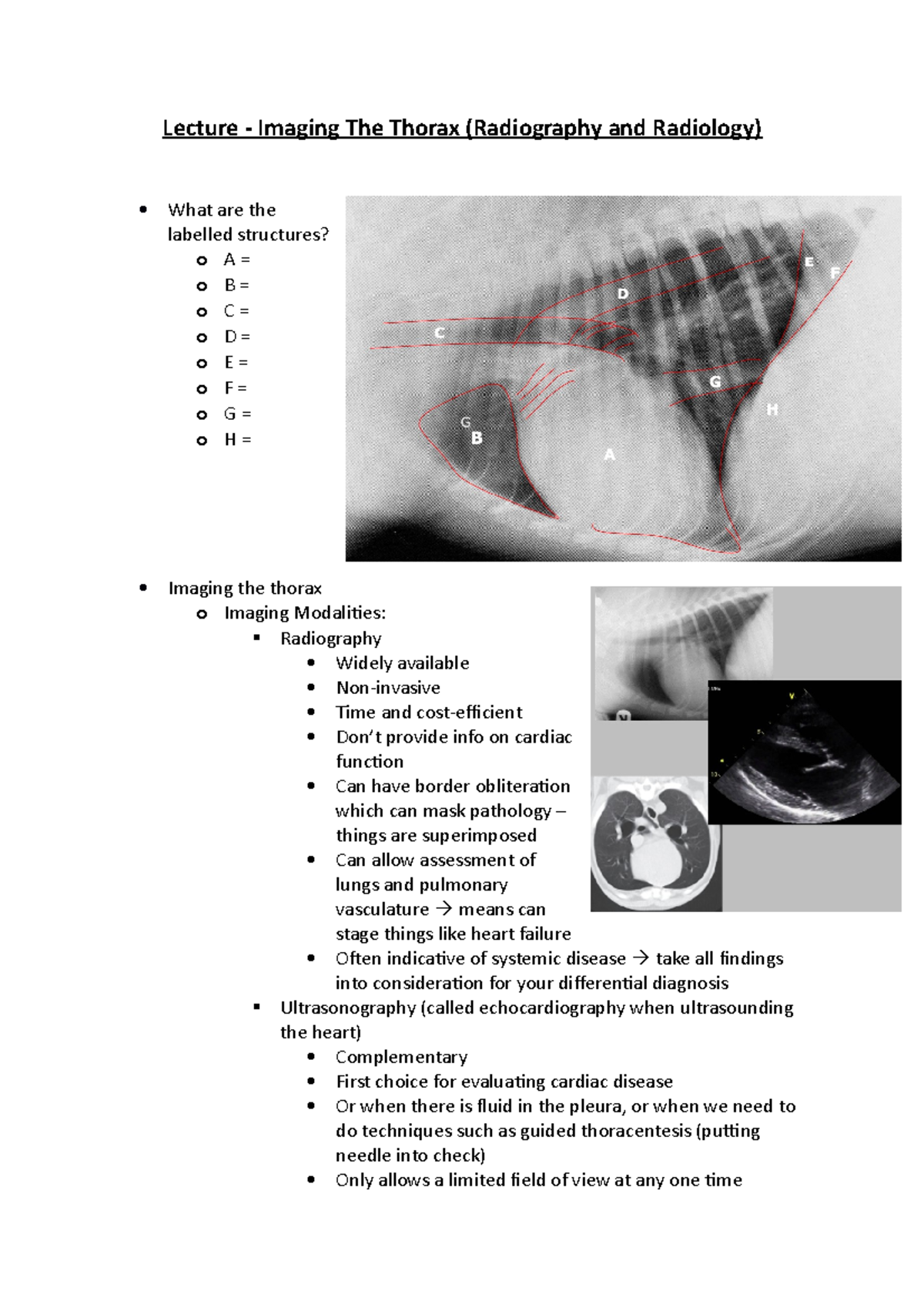 Lecture 49 - Imagine The Thorax (Radiography And Radiology) - Heart ...