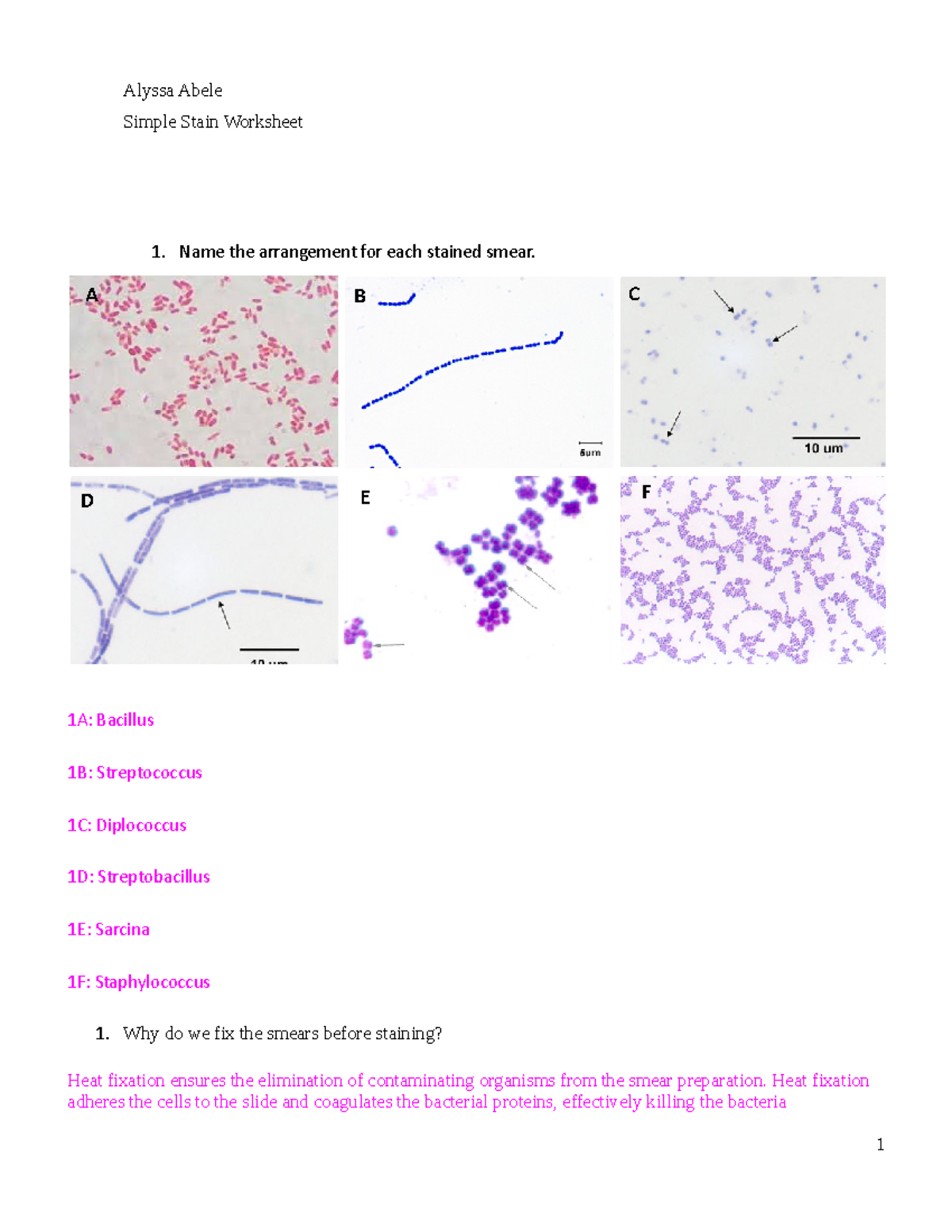 lab-simple-stain-analysis-alyssa-abele-simple-stain-worksheet-name