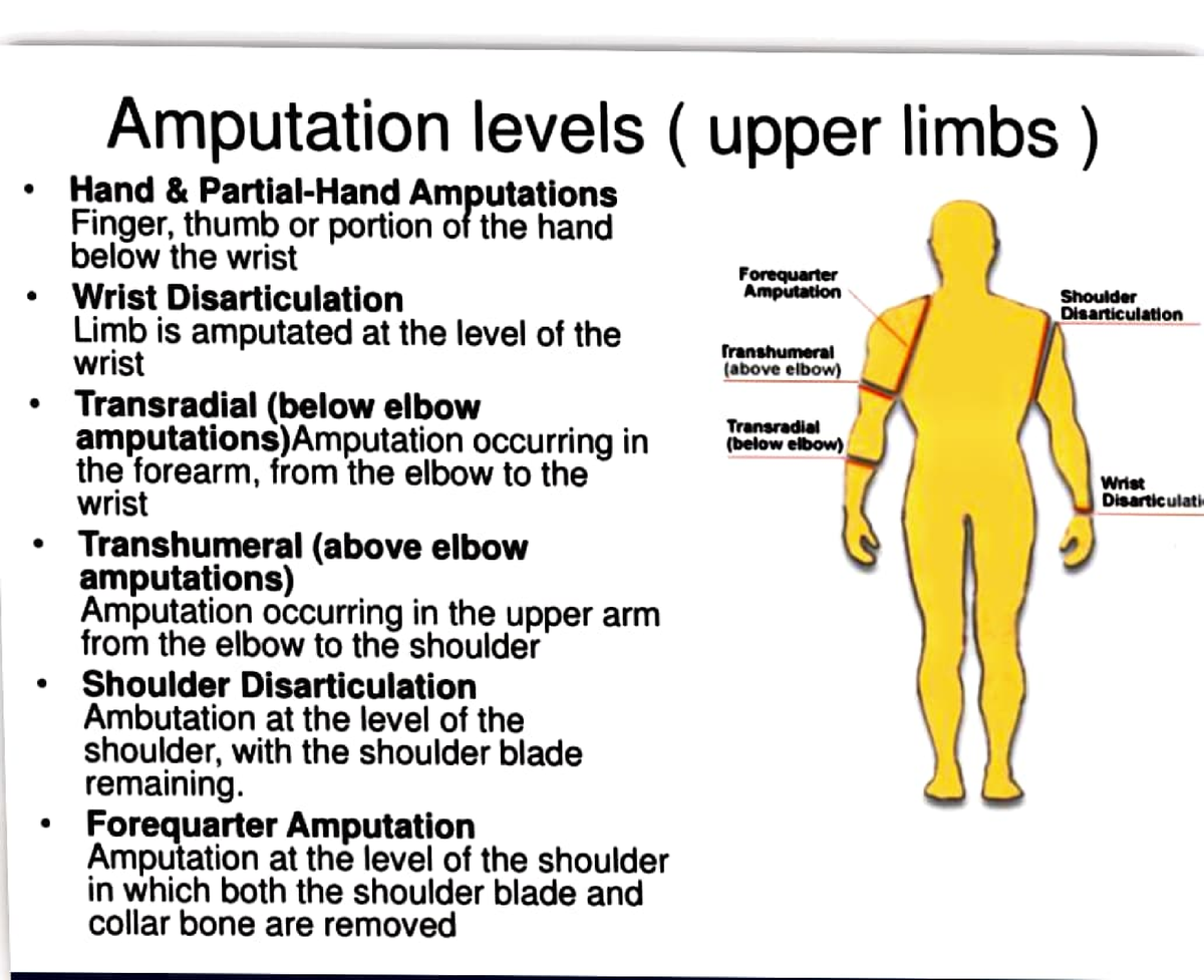 Amputation - Forequarter Amputation Amputation at the level of the ...