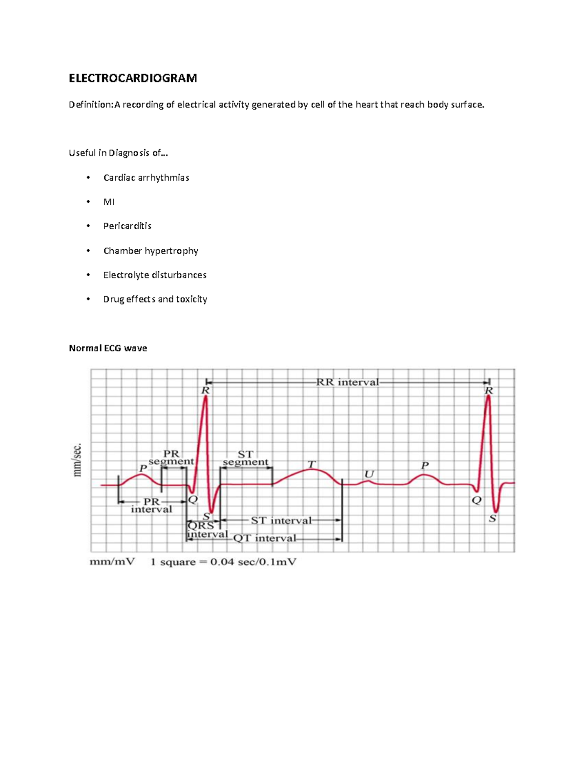 Electrocardiogram - Summary Ecgs Made Easy - Ecgs Made Easy 