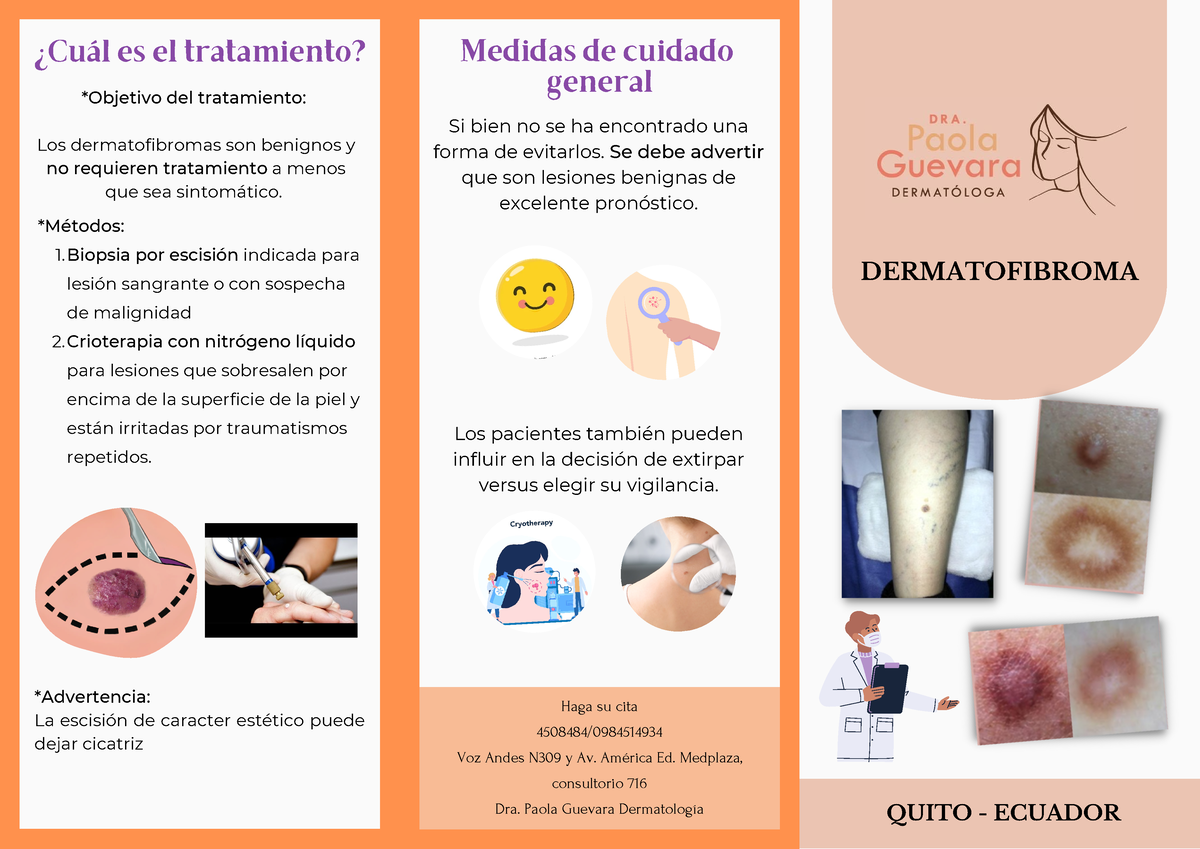 tratamiento de dermatofibroma