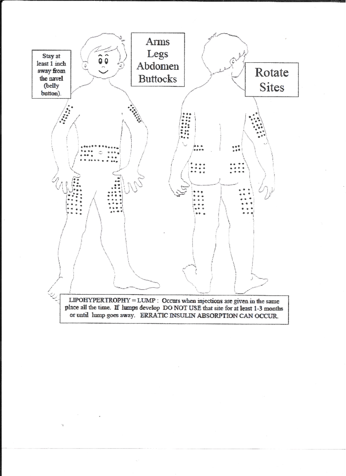 Diabetic site rotation for peds - NURS 430 - Studocu