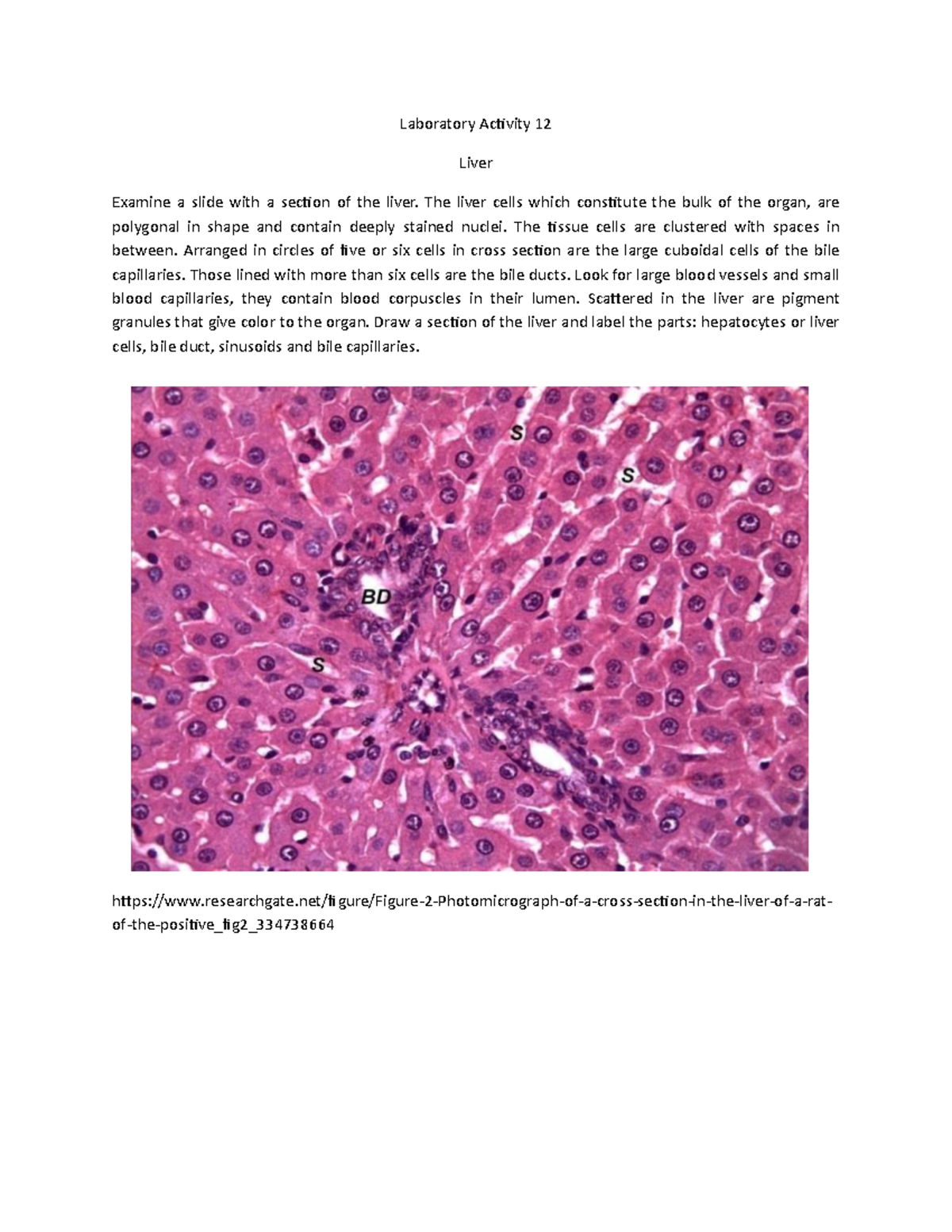 Laboratory Activity 12 Liver - Laboratory Activity 12 Liver Examine a ...