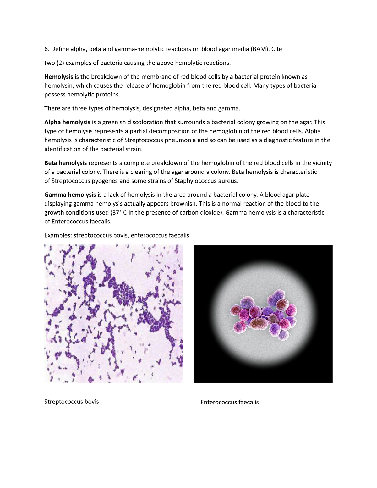 Alpha beta gamma hemolysis - Define alpha, beta and gamma-hemolytic ...