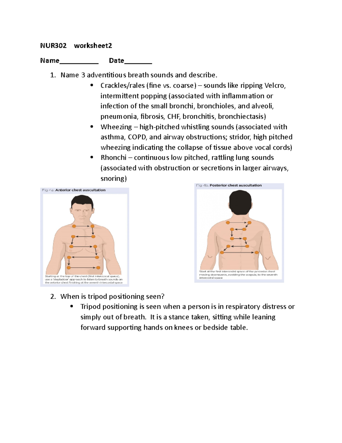 Tripod Position Respiratory Distress