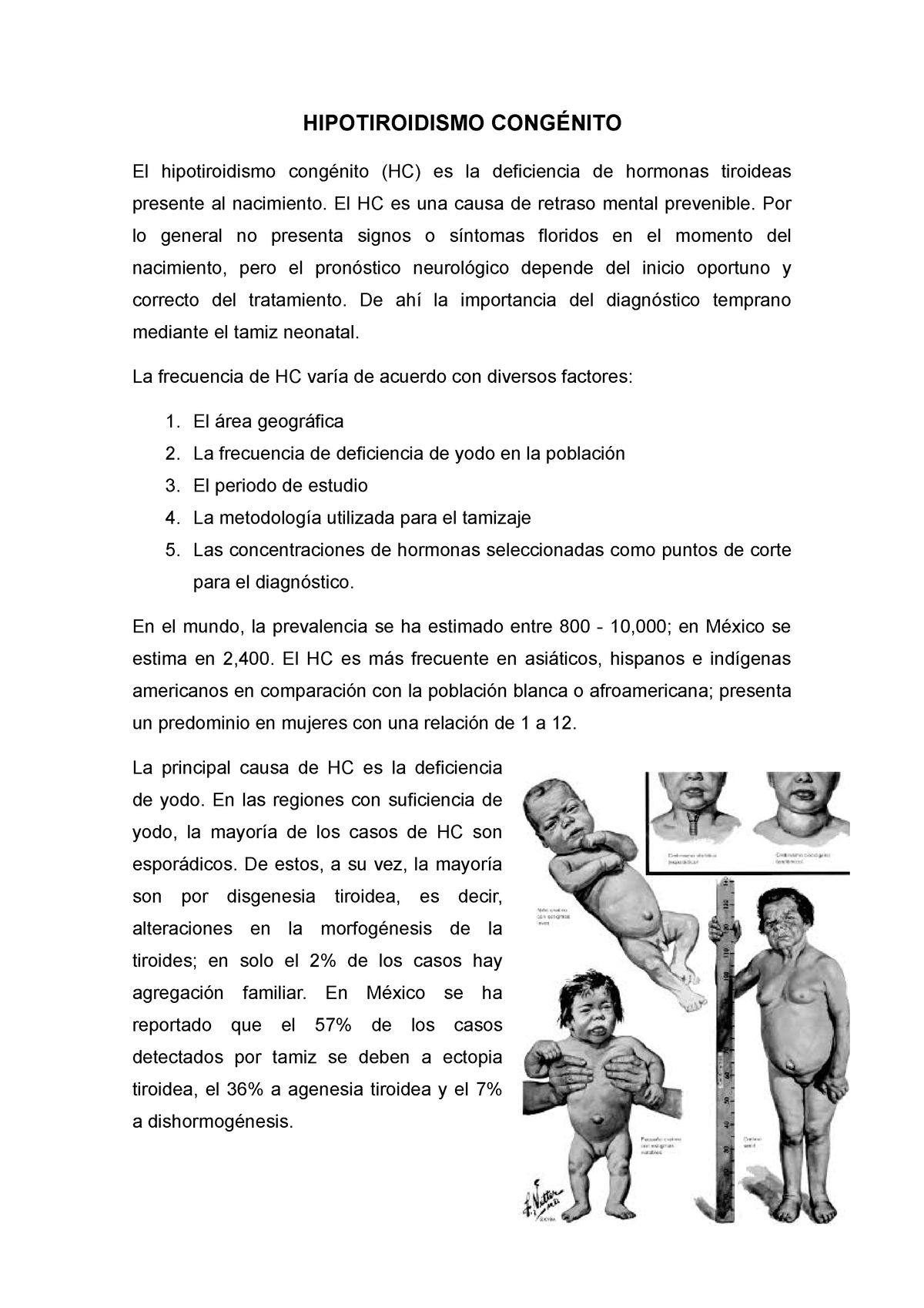 Hipotiroidismo Congénito Hipotiroidismo CongÉnito El Hipotiroidismo