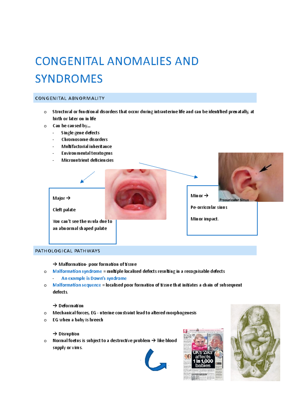 Congenital anomalies jdkajkd - CONGENITAL ANOMALIES AND SYNDROMES ...