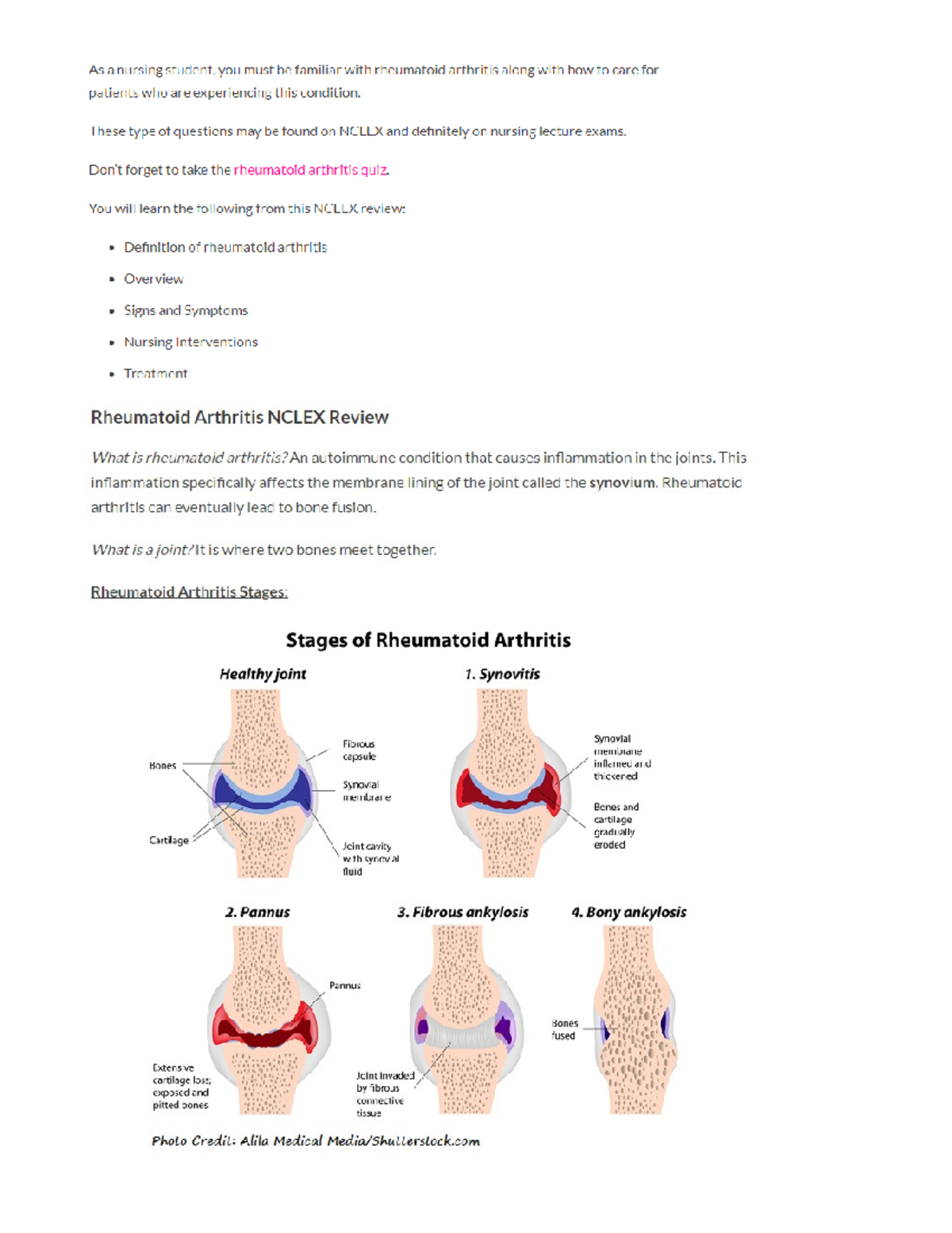 Rheumatoid Arthritis Nclex Review NUR 212 Studocu