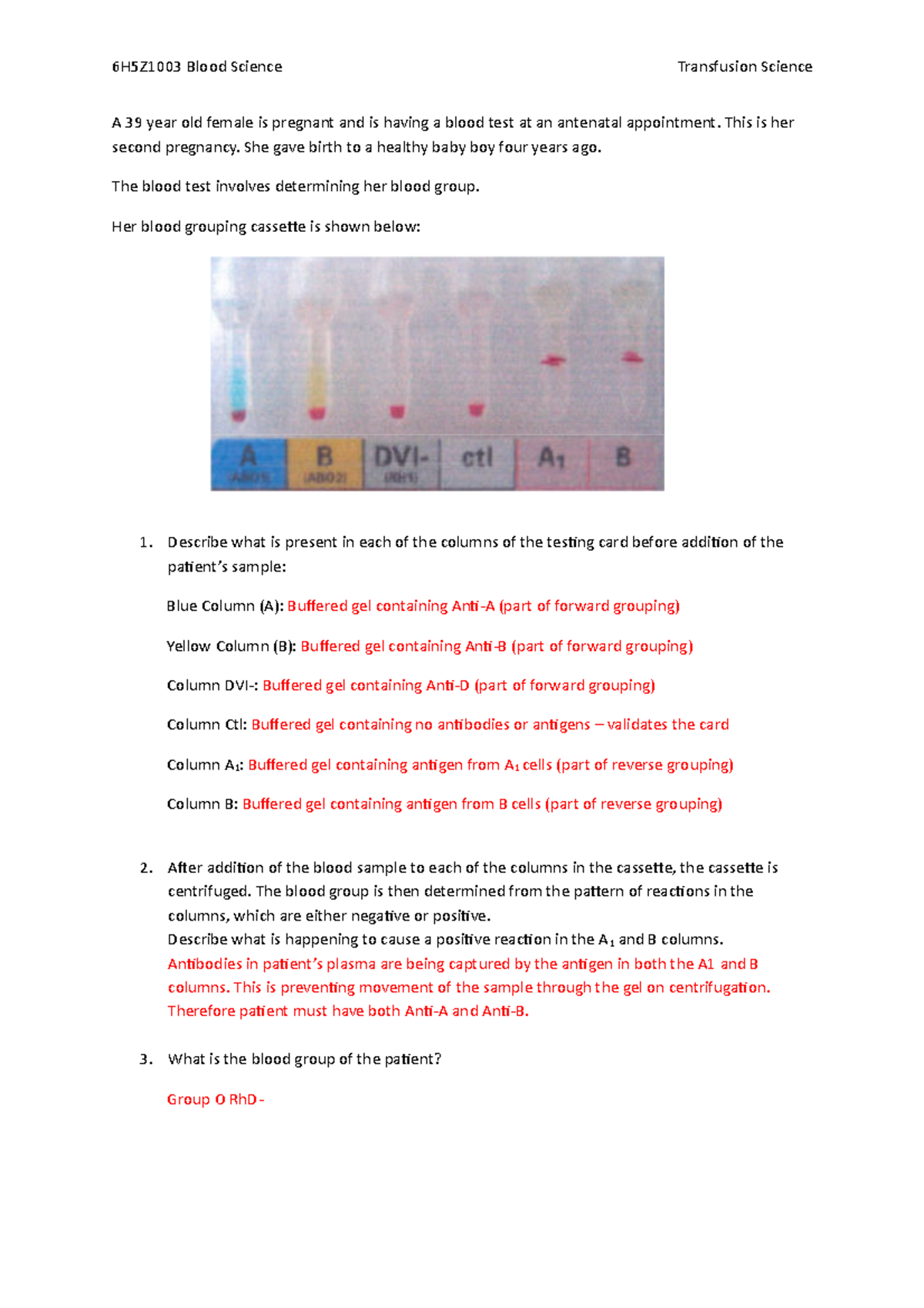 Case study for Transfusion session 6H5Z1003 Blood Science Transfusion
