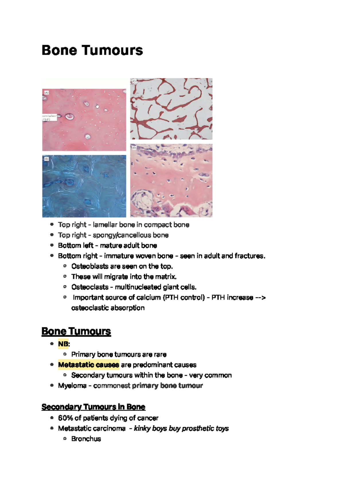 Bone Tumours - B O N E Tu M O U Rs Bone Tumours Secondary Tumours In ...