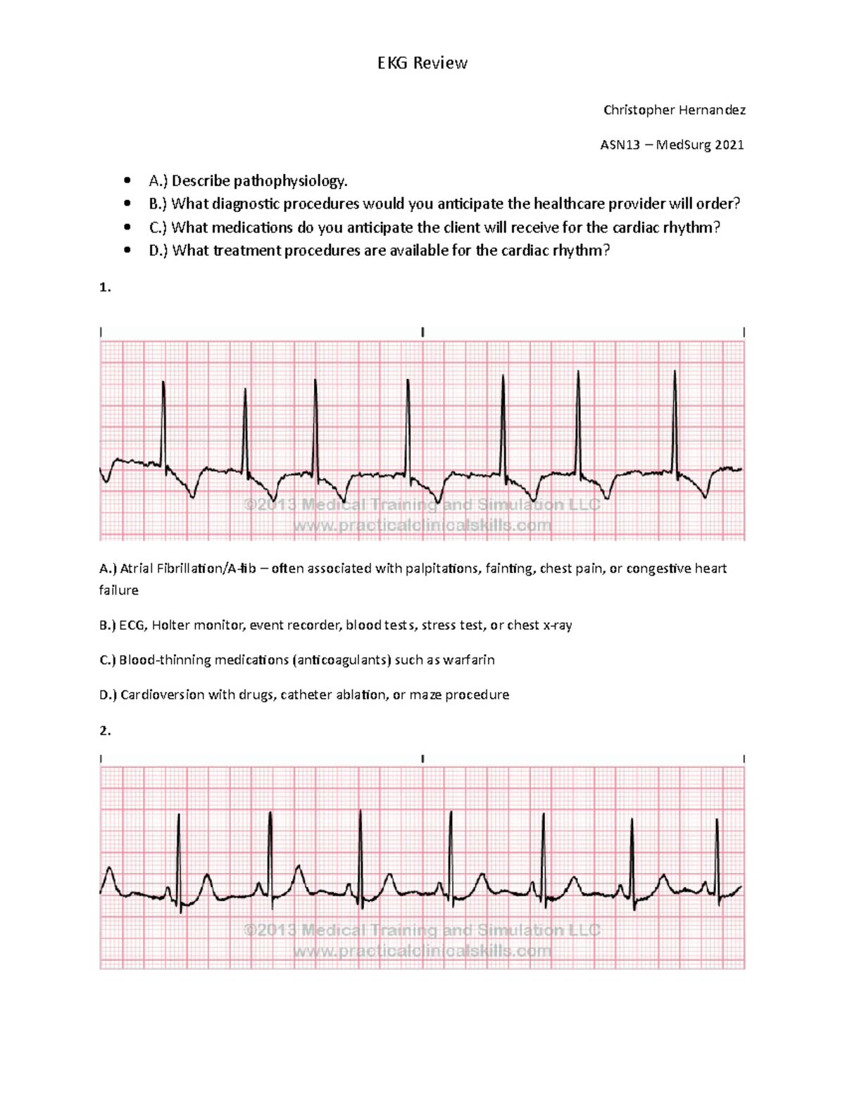 Med-Surg EKG Worksheet - Christopher Hernandez ASN13 – MedSurg 2021 A ...