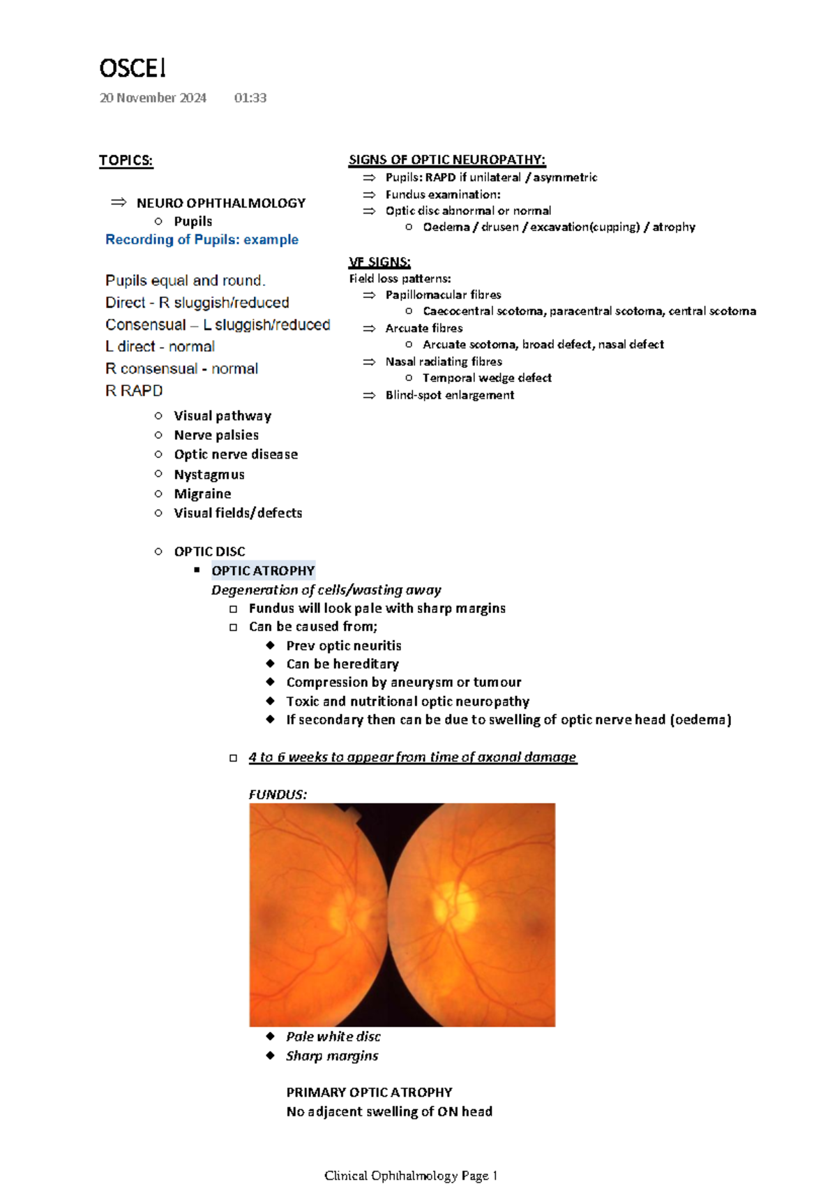 OSCE - mn. af. nd - TOPICS: NEURO OPHTHALMOLOGY Pupils Visual pathway ...