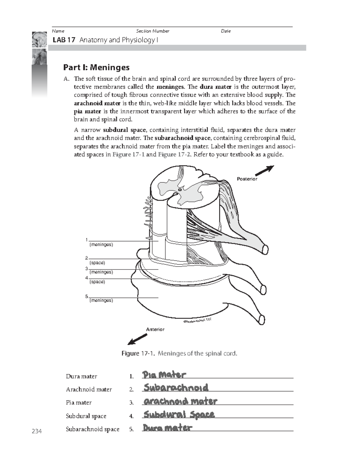 Lab 17 - A&P 2 - LAB 17 Anatomy and Physiology I Part I: Meninges A ...