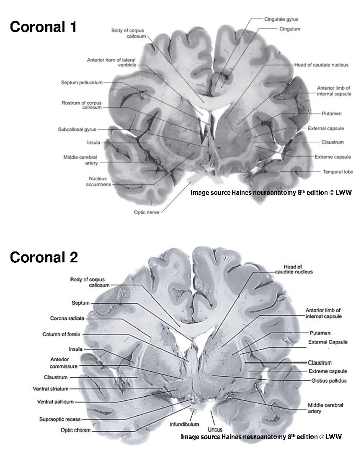 Coronal-Horizontal-Sagittal Labelled - Coronal 1 Coronal 2 Coronal 3 ...