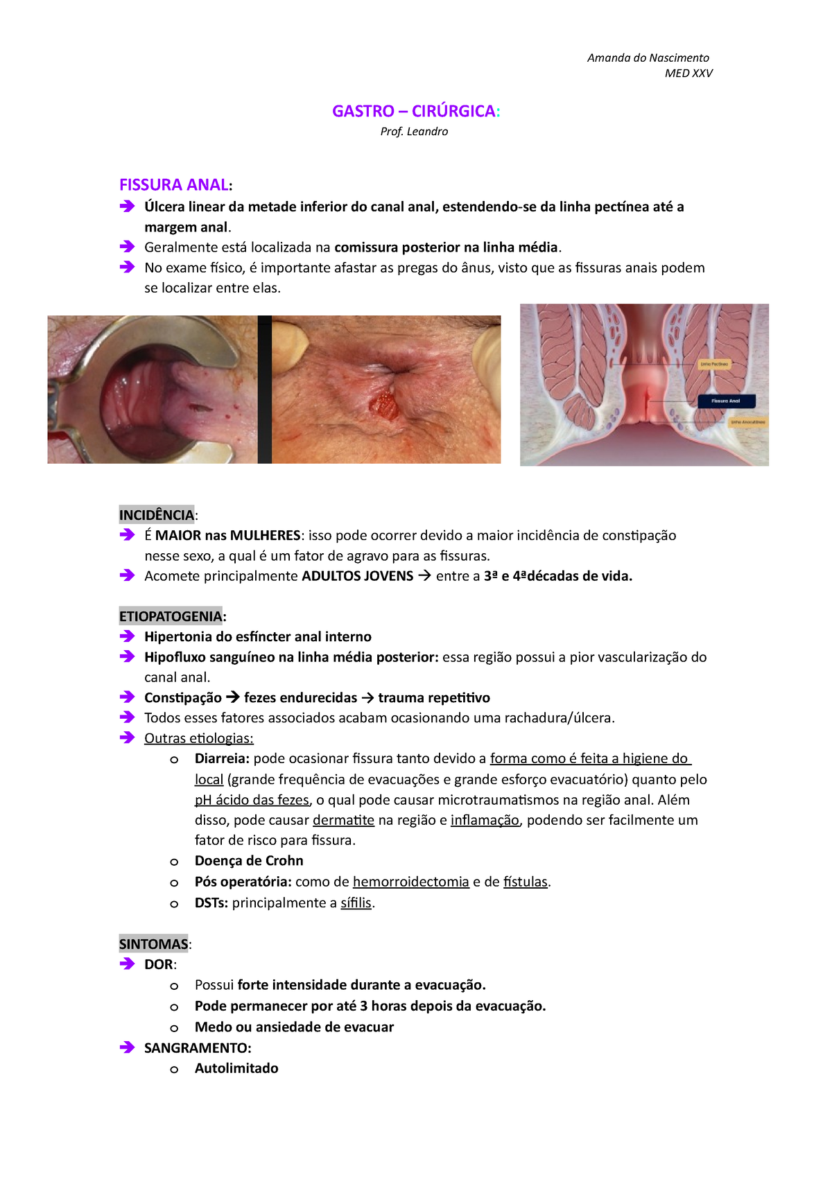 9. Resumo Fissura Anal e Processos Infecciosos do canal anal e ânus - MED  XXV GASTRO – CIRÚRGICA: - Studocu