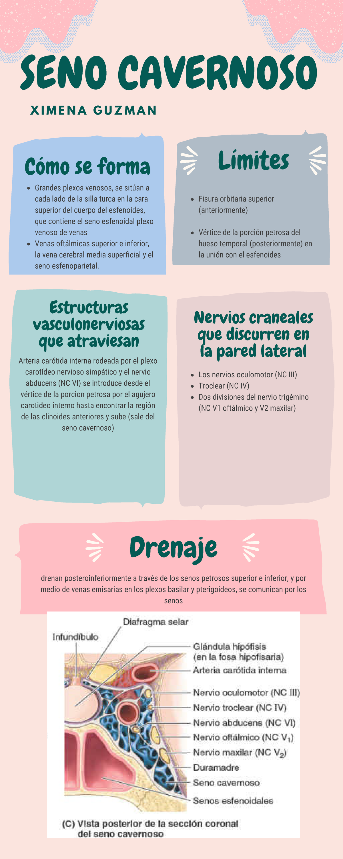 Infografia seno cavernosos Cómo se forma Límites Drenaje SENO CAVERNOSO Nervios craneales que