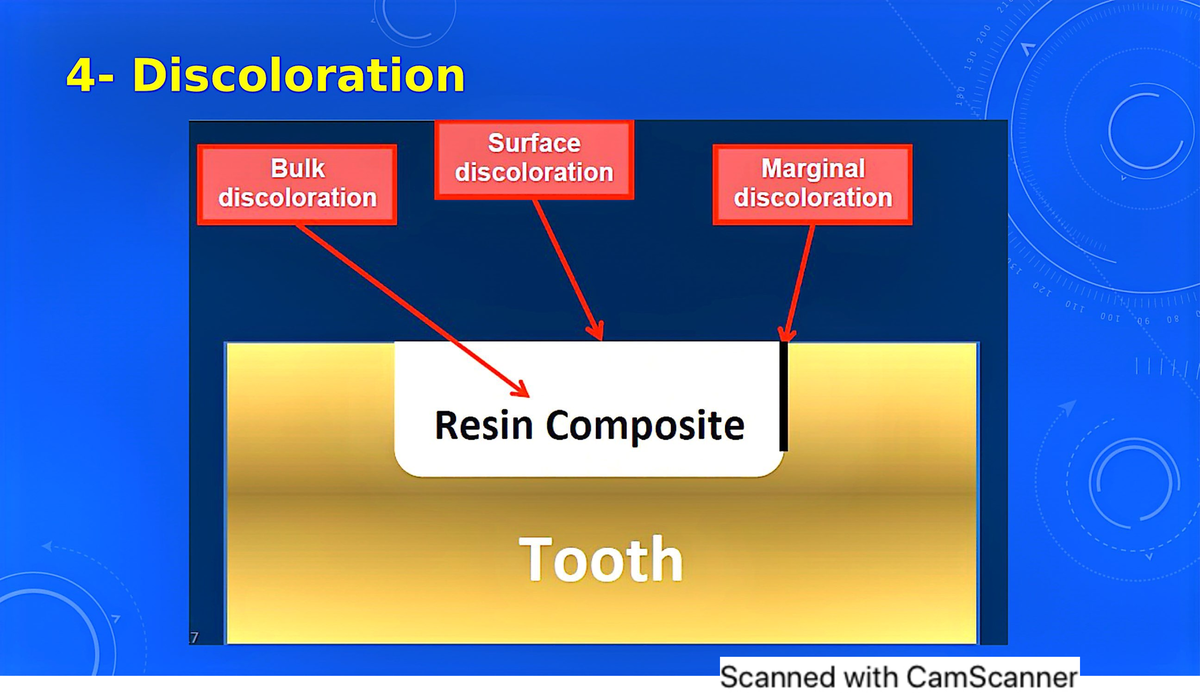 Failure of restoration 7 endodontic dentistry Studocu