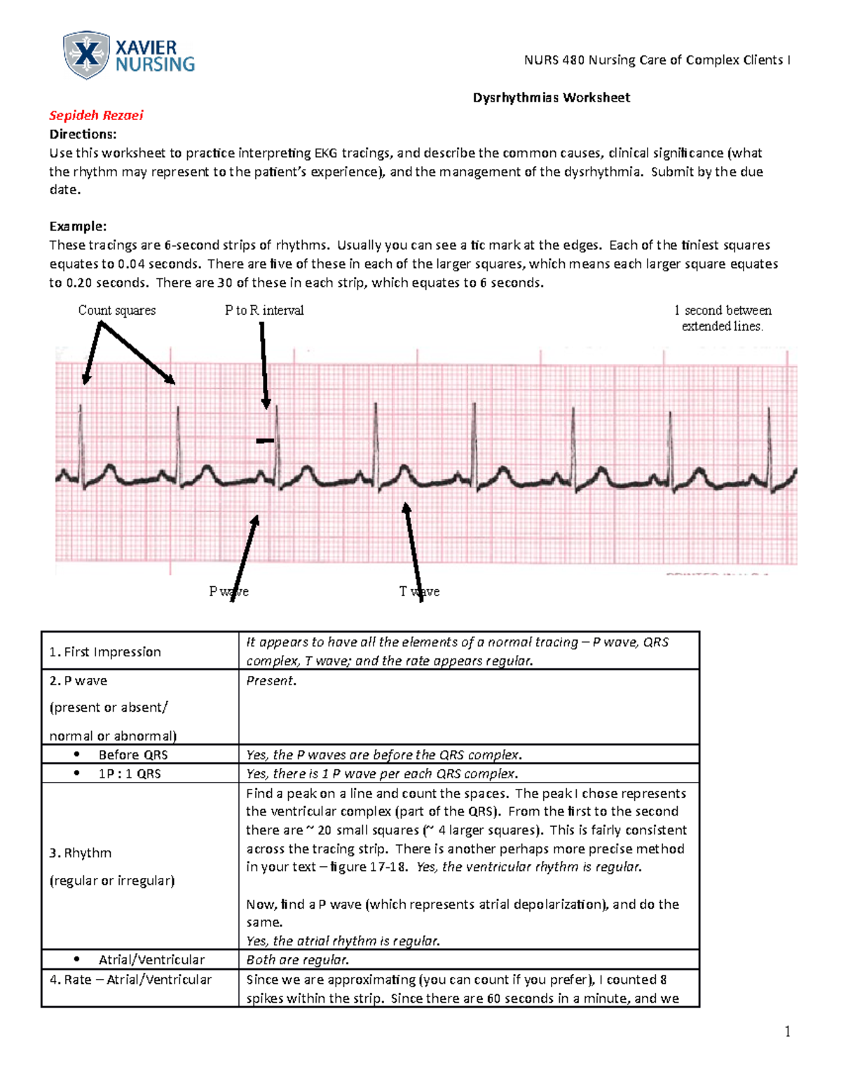 Dysrhythmias Worksheet - Dysrhythmias Worksheet Sepideh Rezaei ...