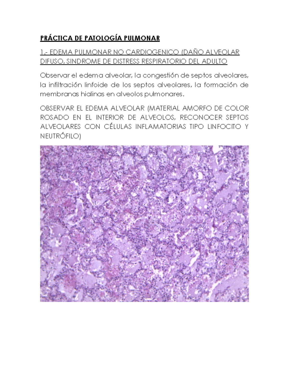 2° Practica DE I FASE Patología II (1) PR¡CTICA DE PATOLOGÕA