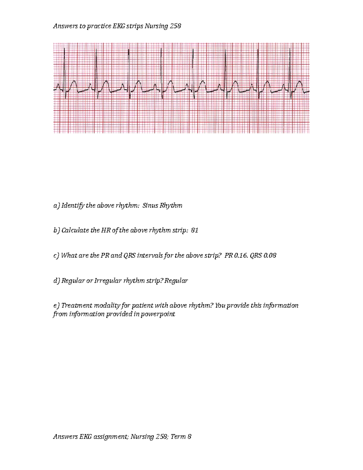 Answers Ekg Assignment; Term 8 - A) Identify The Above Rhythm: Sinus 