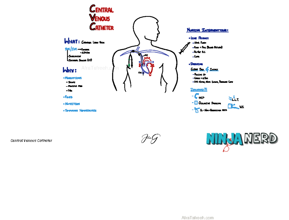Central Venous Catheter - o E E AE I É p s g É rip E É j I ee E if É o ...