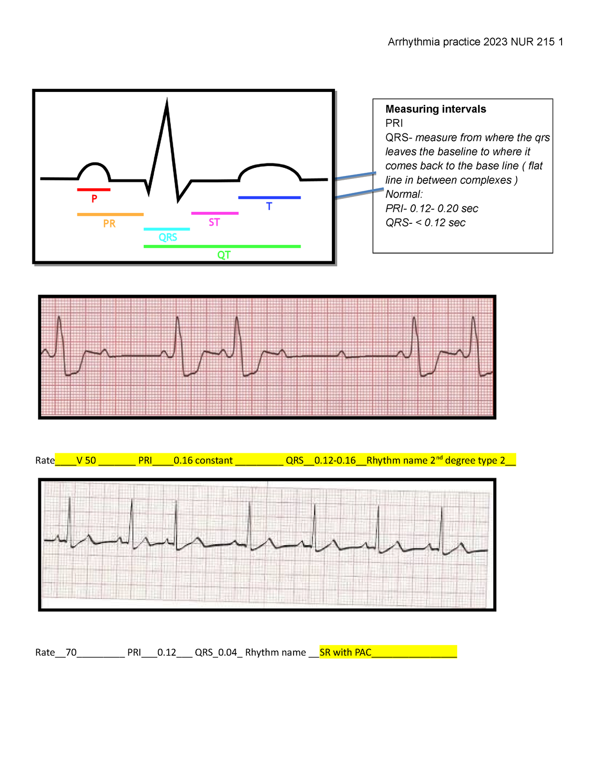 General concepts rhythms answers - Rate____V 50 _______ PRI____0 ...