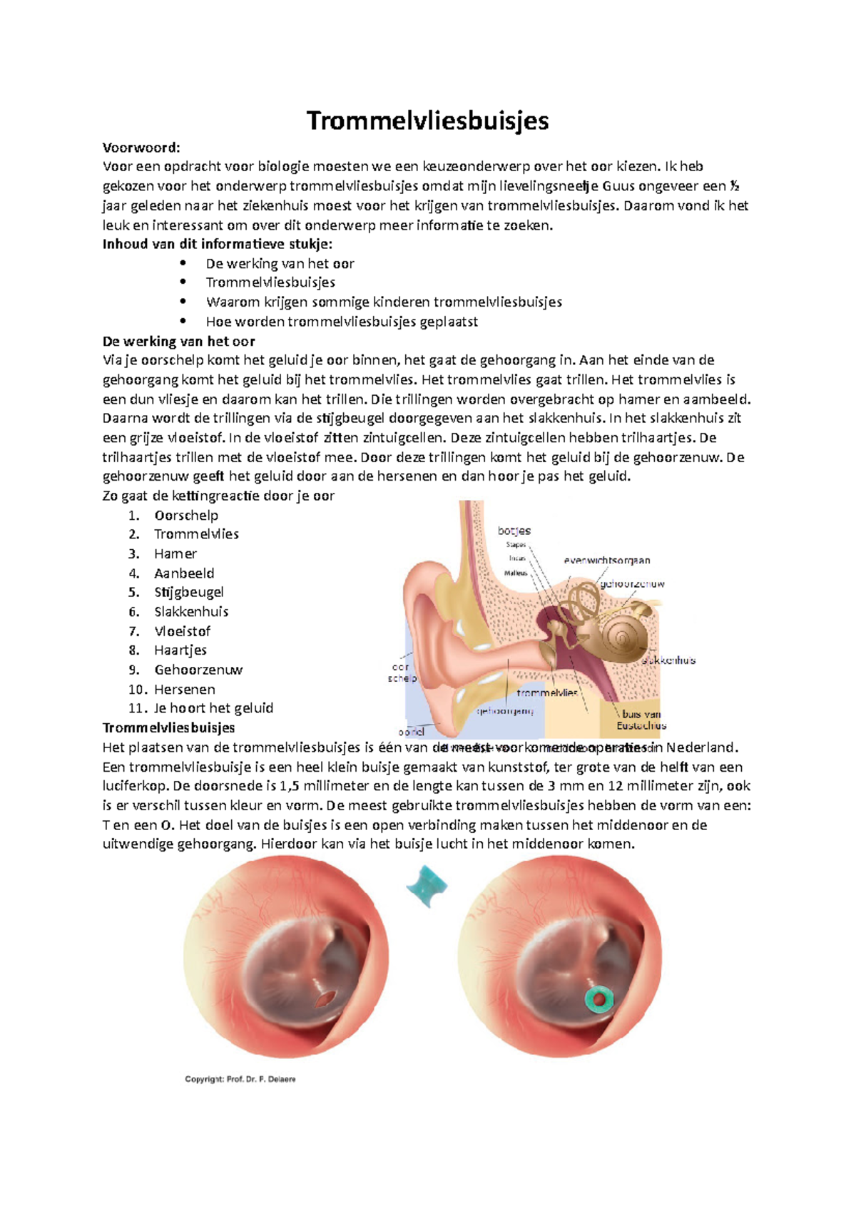 Kopie van biologie oor - oor - Trommelvliesbuisjes Voorwoord: Voor een ...
