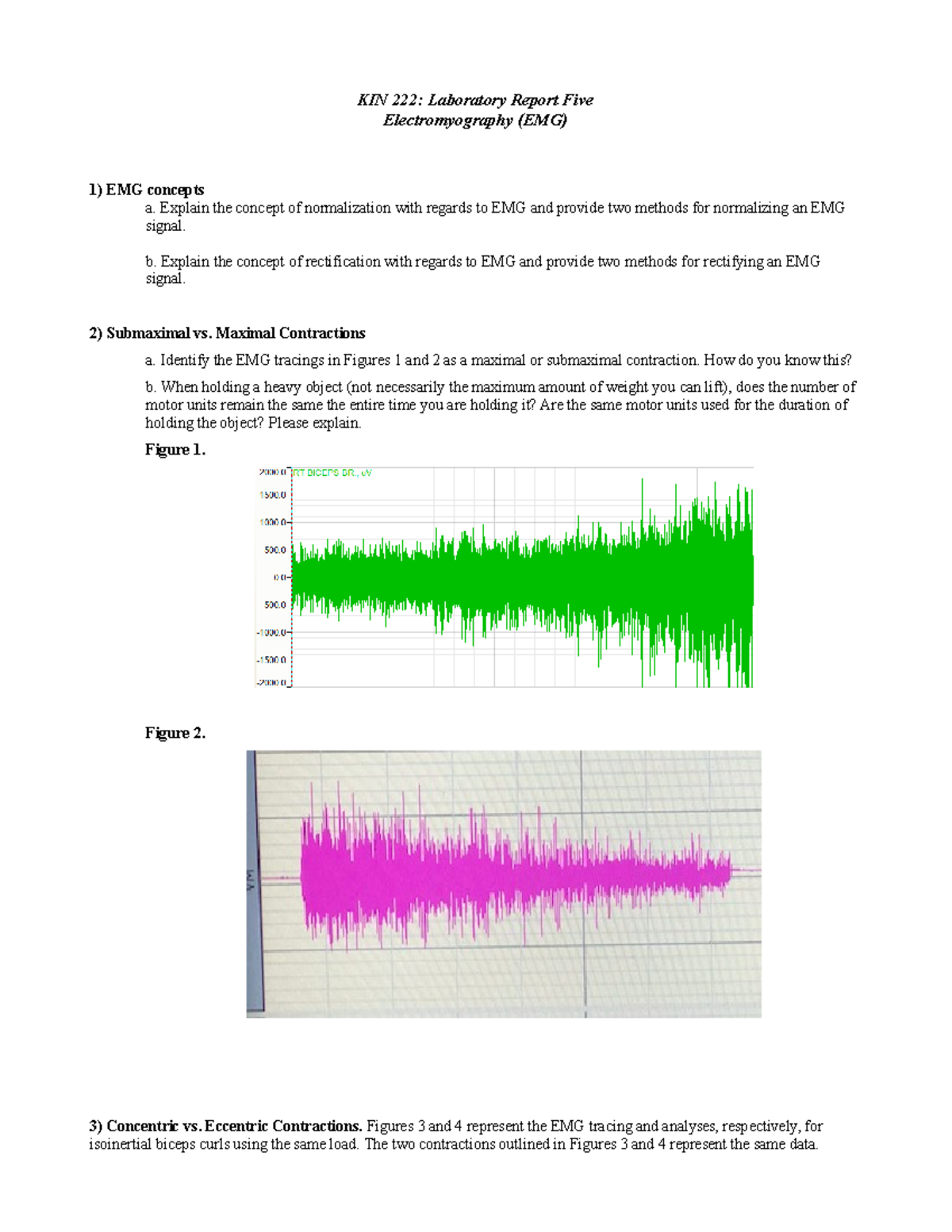 EMG Lab Report - Emg Lab - KIN 222: Laboratory Report Five ...