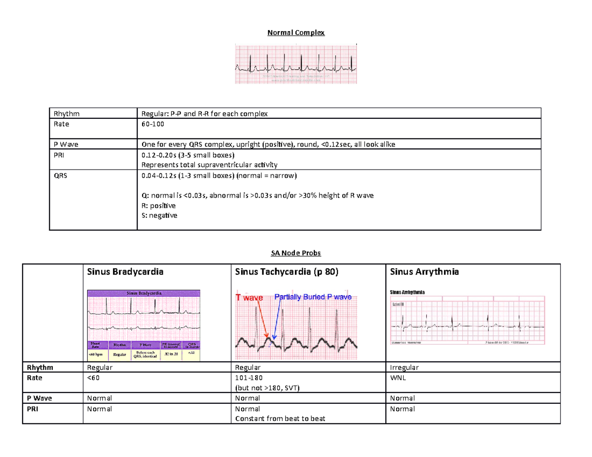 ECG outline - Normal Complex Rhythm Regular: P-P and R-R for each ...