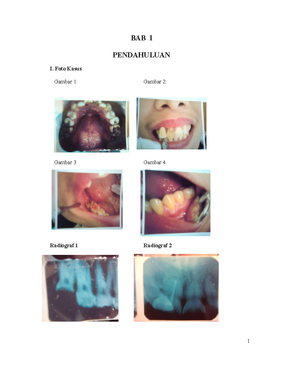 Identifikasi karies - BAB I PENDAHULUAN I. Foto Kasus Gambar 1 Gambar 2