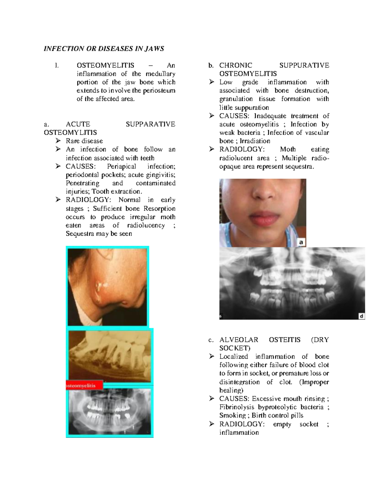 Infection OR Diseases IN JAWS INFECTION OR DISEASES IN JAWS I