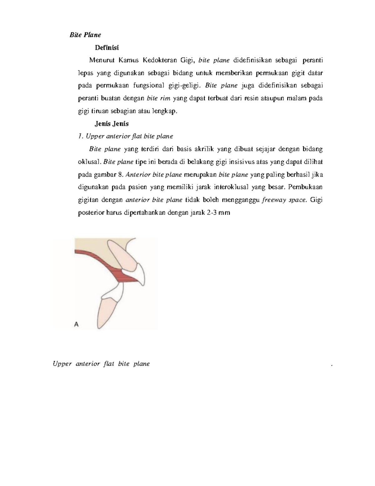 bite-plane-orthodonsia-bite-plane-definisi-menurut-kamus-kedokteran