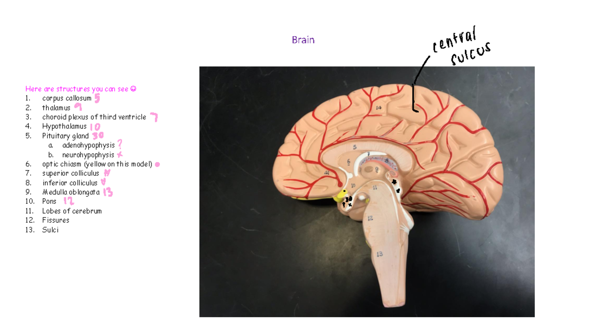 Lab+models+for+Lab+3+Gardner - Brain Here are structures you can see ...