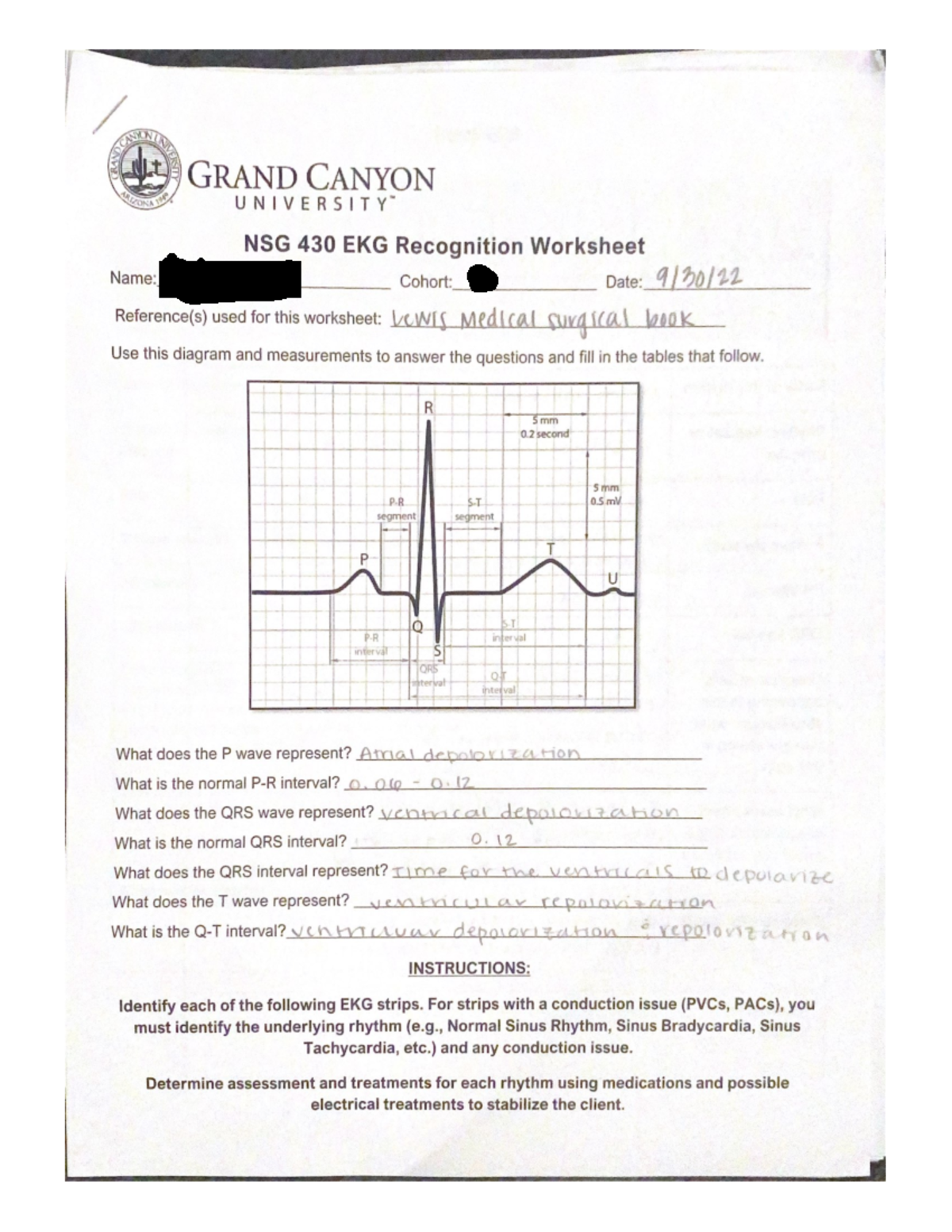 Ecg Ecg Worksheet Answers Nsg Studocu