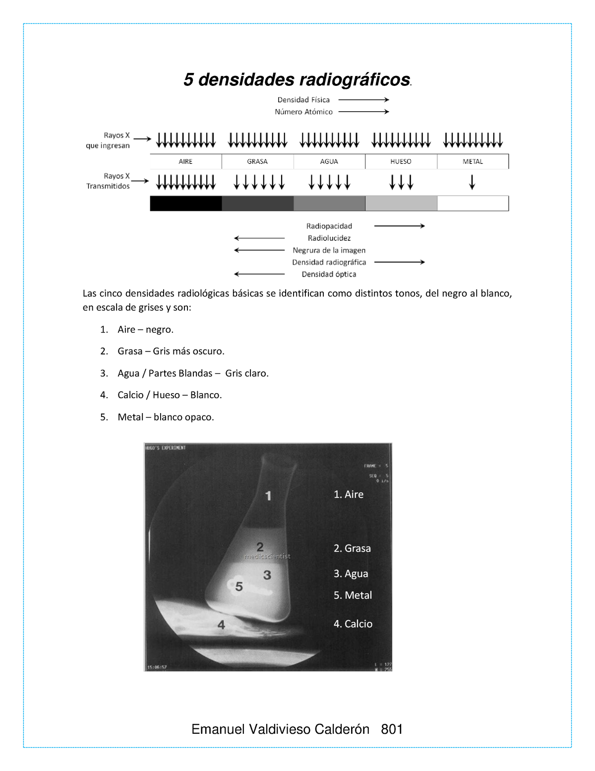 Densidades Radiogr Ficos Las Cinco Densidades Radiol Gicas B Sicas