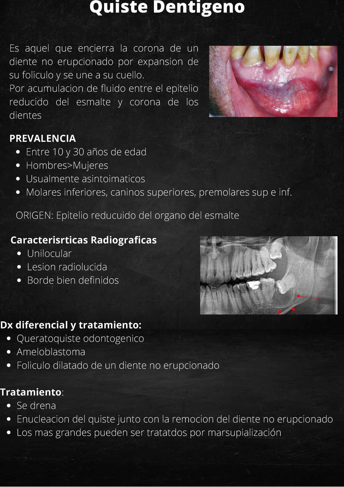 Quiste Dentigero - PATOLOGIAS BUCALES PARA EL AREA DE ODONTOLOGIA, DEL ...