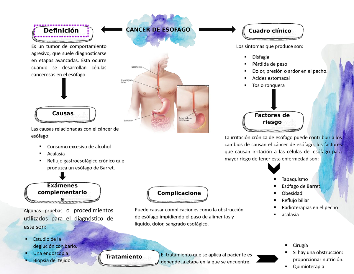 Mapa Conceptuales Gstroenterologia Definici N Cancer De Esofago The Best Porn Website